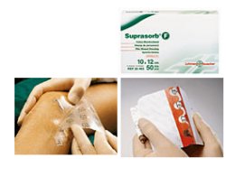 MEDICAZIONE STERILE IN FILM IN POLIURETANO TRASP. SUPRASORB F 10X12CM 10 PEZZI - Doctor Vinz
